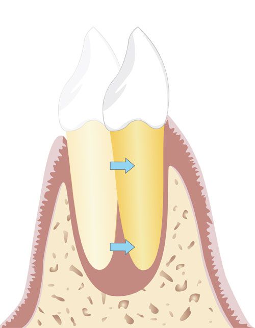 Körperliche Zahnbewegung