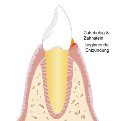 Parodontologische Kieferorthopädie